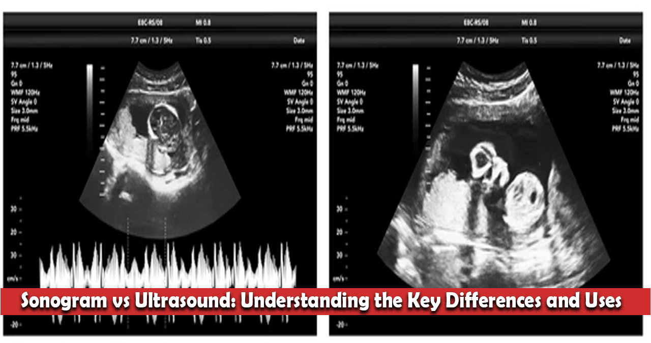 Sonogram vs Ultrasound