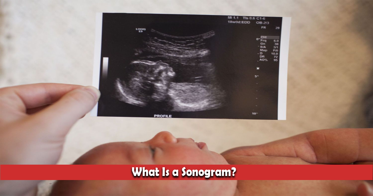 What Is a Sonogram?